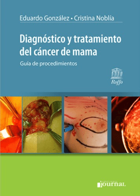 Diagnóstico y Tratamiento del Cáncer de Mama Guía de procedimientos - Noblía1