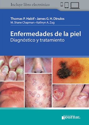 Habif, Enfermedades de la Piel. Diagnóstico y tratamiento