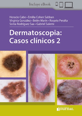 Cabo Dermatoscopia Casos Clinicos 21