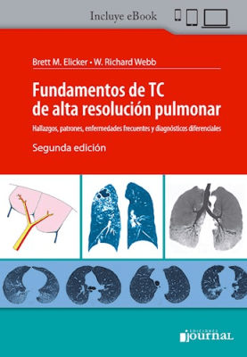 Webb Fundamentos de TC de alta resolución pulmonar - 2ª Ed.
