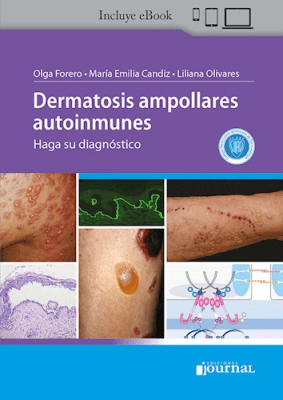 Forero, Dermatosis Ampollares Autoinmunes