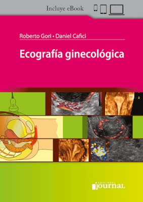 Gori  Ecografía Ginecológica