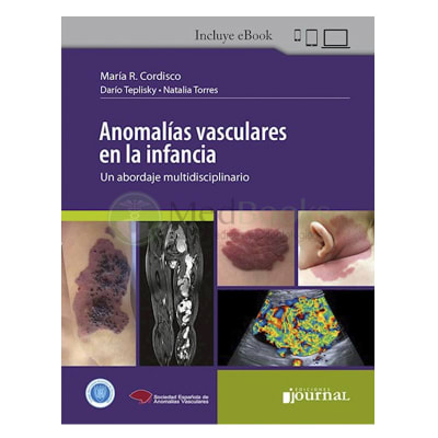 Anomalías Vasculares en la Infancia - Maria Cordisco