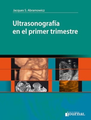 Ultrasonografia en el Primer Trimestre 1 - Abramowicz