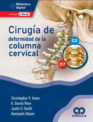 Cirugia de la Deformidad de la Columna Cervical Ames, C. - Riew, K