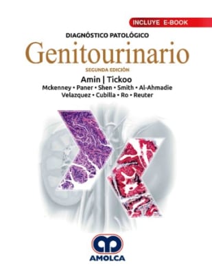 Diagnostico Patologico Genitourinario Amin, M..