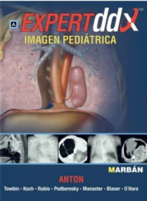 Anton, Imagen Pediatrica Expert ddx