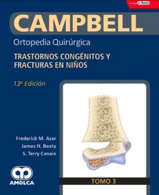 CAMPBELL Ortopedia Quirúrgica, T.3: Trastornos Congénitos y Fracturas en Niños, Azar