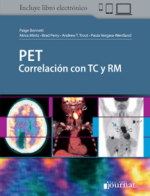 PET: Correlación con TC y RM Bennet1