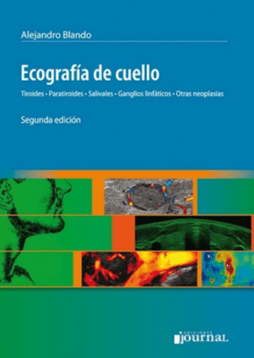 Ecografia de cuello, tiroides, paratiroides, salivales, ganglios linfaticos y otras neoplasias - Blando