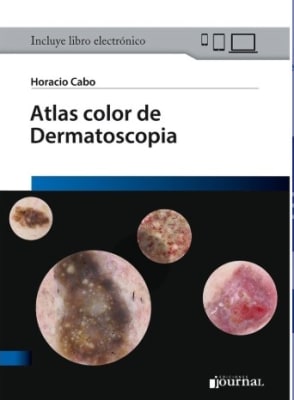 Atlas color de Dermatoscopia Cabo