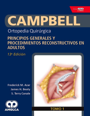 CAMPBELL Ortopedia Quirúrgica, T1 Principios Generales y Procedimientos Reconstructivos