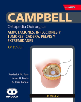 CAMPBELL Ortopedia Quirúrgica, Tomo 2: Amputaciones, Infecciones y Tumores: Cadera, Pelvis y Extremi
