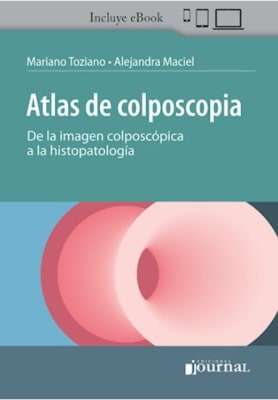 Atlas de Colposcopia - Mariano Tosciano