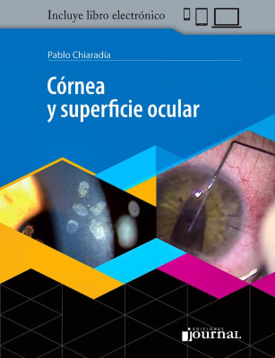 Córnea y Superficie Ocular Chiaradía, P.1