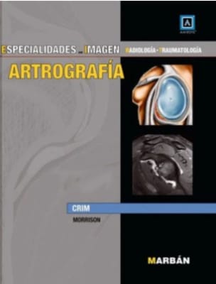 Especialidades en Imagen: ARTROGRAFIA - CRIM Amirsys1