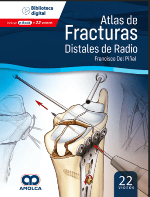 DEL PIÑAL, Atlas de Fracturas Distales de Radio.