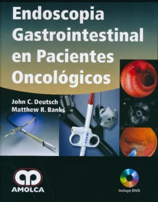 Endoscopia Gastrointestinal en Pacientes Oncológicos Deutsch