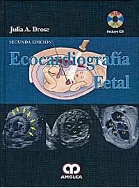 Ecocardiografia Fetal Drose