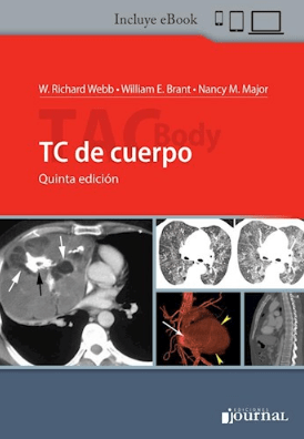 Webb TC de Cuerpo 5ª ed. + ebook