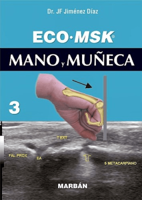 Eco MSK Mano y Muñeca