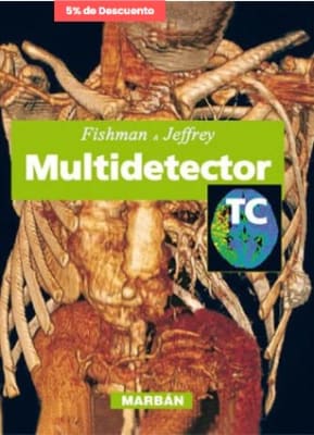 Fishman Multidetector TC1