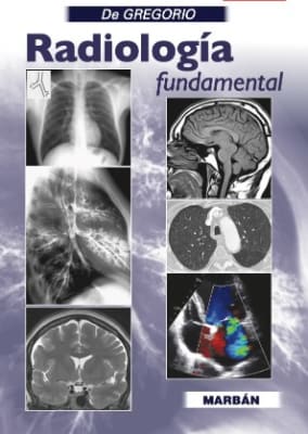 De Gregorio Radiología Fundamental