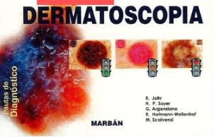 Dermatoscopía Johr
