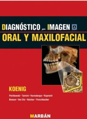 Koenig Diagnostico por Imagen Oral y Maxilofacial