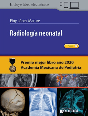 Radiologia Neonatal  Lopez Marure