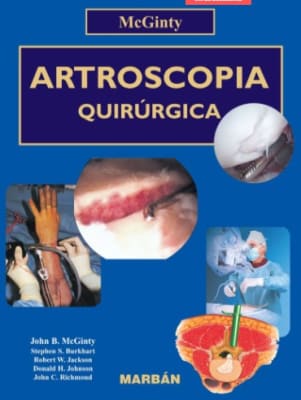 McGinty Artroscopia Quirurgica