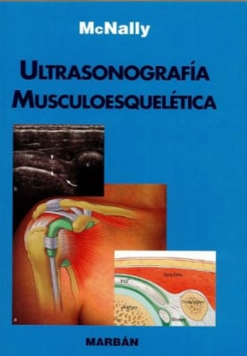 McNally, Ultrasonografia musculoesqueletica