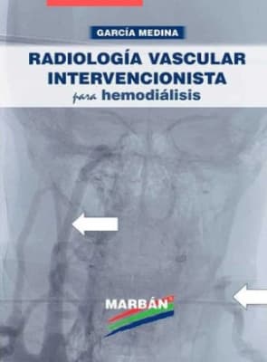 Radiología vascular intervencionista para hemodiálisis - Medina