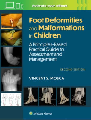 Foot Deformities and Malformations in Children: A Principles-Based, Practical Guide to Assessment an1