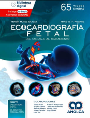 Ecocardiografía Fetal. Del Tamizaje al Tratamiento - Muñoz