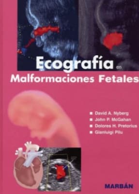 Ecografía en Malformaciones Fetales - Nyberg
