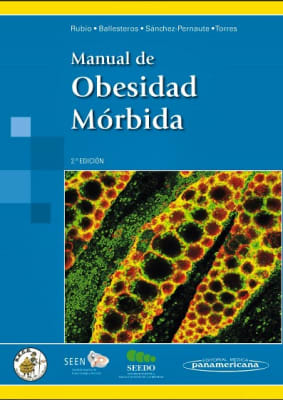 Rubio Manual De Obesidad Morbida 2Ed