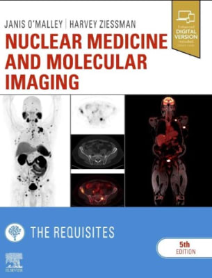 Nuclear Medicine and Molecular Imaging: The Requisites O'Malley MD
