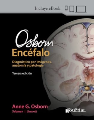 Osborn, el Encefalo 3° Ed. Anne Osborn