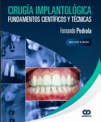 Cirugía Implantológica. Fundamentos Científicos y Técnicas