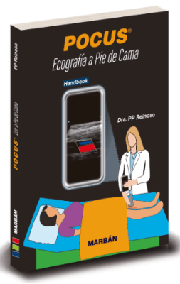 POCUS Ecografía a pie de cama - Pocket Espiral1