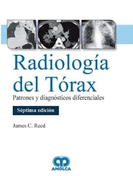 Reed Radiologia del Torax. Patrones y Diagnosticos Diferenciales