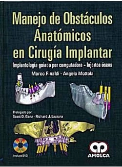Manejo de Obstáculos Anatómicos en Cirugía Implantar. Guiada x Computadora - Injerto