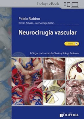 Neurocirugia Vascular Rubino, Roman y Bottan1
