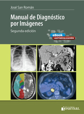 Manual de Diagnostico por Imagenes - 2ª ed. San Román1