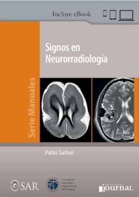 Signos de Neuroradiologia - Sartori