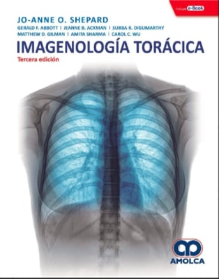 Imagenología Torácica  Serie los Requisitos Shepard 3° ed.1