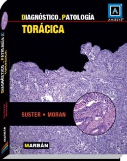 Suster, Diagnostico en Patologia Toracica