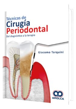 Técnicas de Cirugía Periodontal. Del Diagnóstico a la Terapia Tarquini1