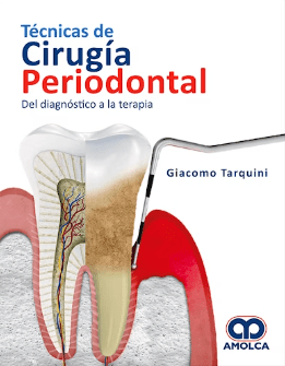 Técnicas de Cirugía Periodontal. Del Diagnóstico a la Terapia Tarquini